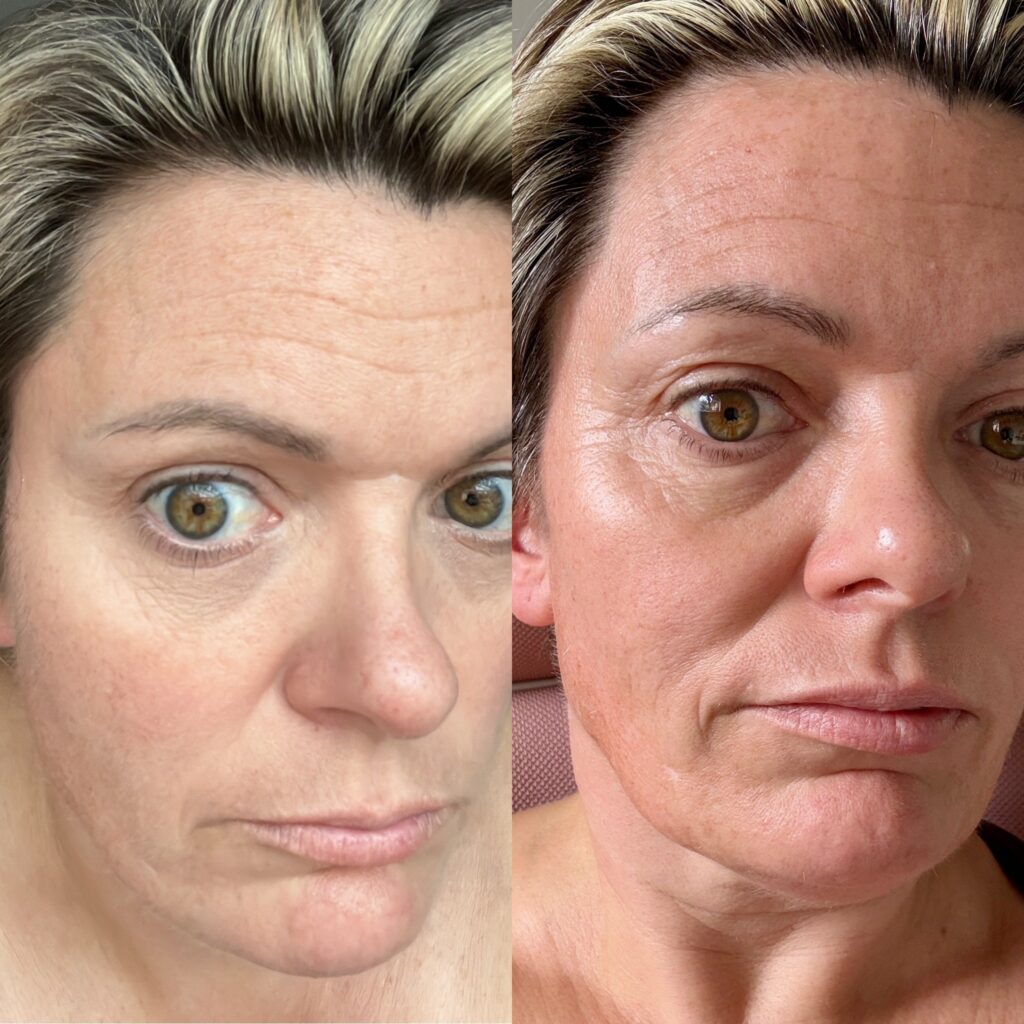 After 3 months of drinking Elavate Collagen Supplement my skin looked brighter, plumper, more hydrated and that glow!